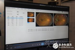 AI賦能眼科醫(yī)療 至真互聯(lián)以網(wǎng)絡(luò)技術(shù)研發(fā)推動行業(yè)革新